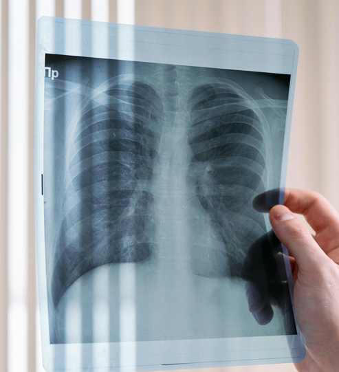 [On-Demand] Screen California 2023: Lung Cancer Screening in the Greater Los Angeles Area Banner