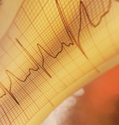 UCLA Heart Failure Symposium 2025: State-of-the-Art Updates & Therapies for Advanced Heart Failure Banner